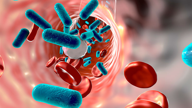 "Unlocking the Key to Effective Fluid Strategies for Sepsis Treatment"