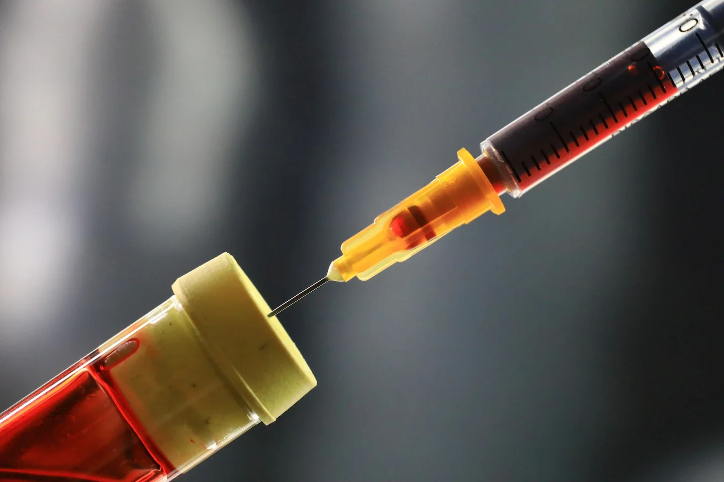 Blood-based clock hints at timing of Alzheimer’s symptom onset