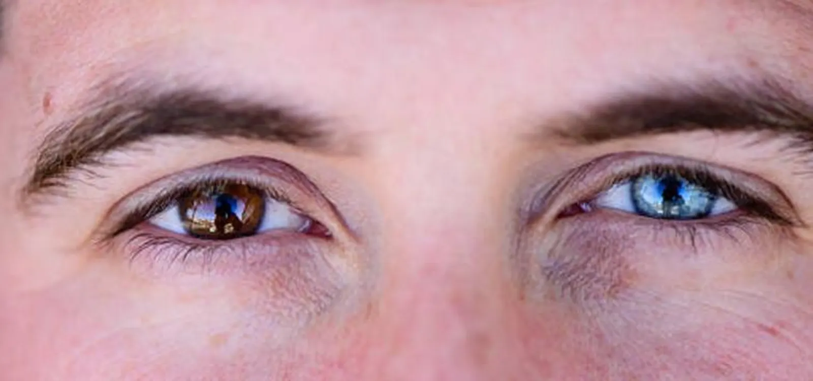 AI Deciphers Genetic Links to Mental Health Disorders