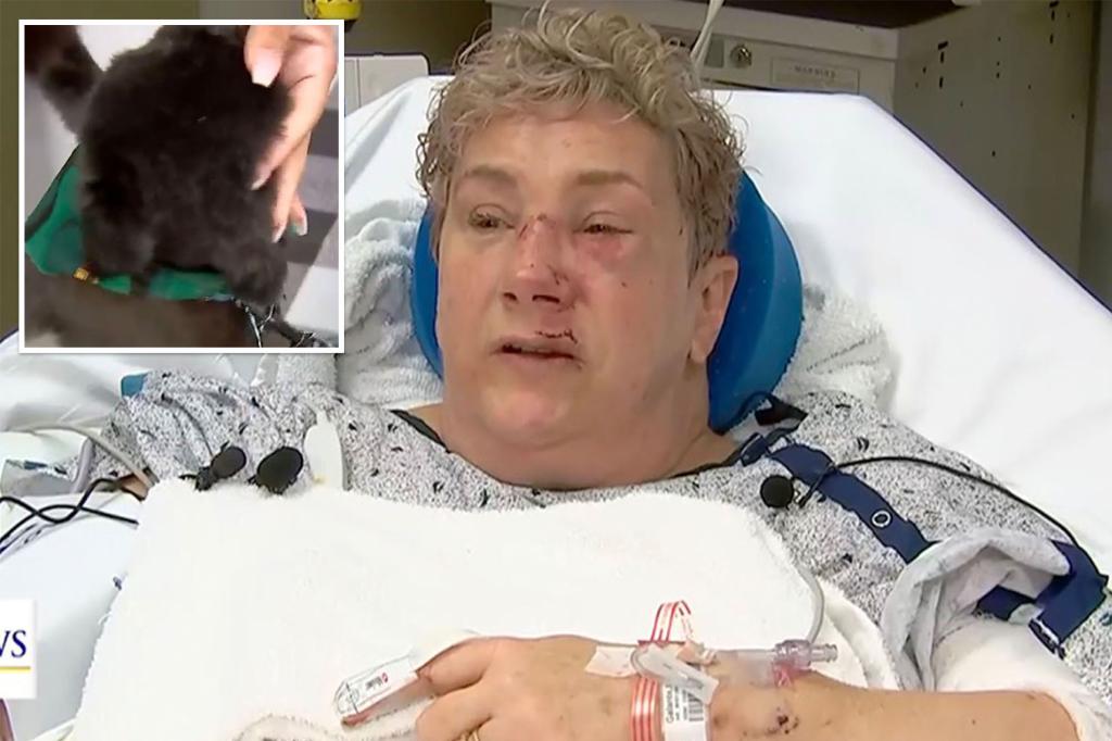 Featured image for Woman Survives Terrifying Bear Attack in Pennsylvania Backyard