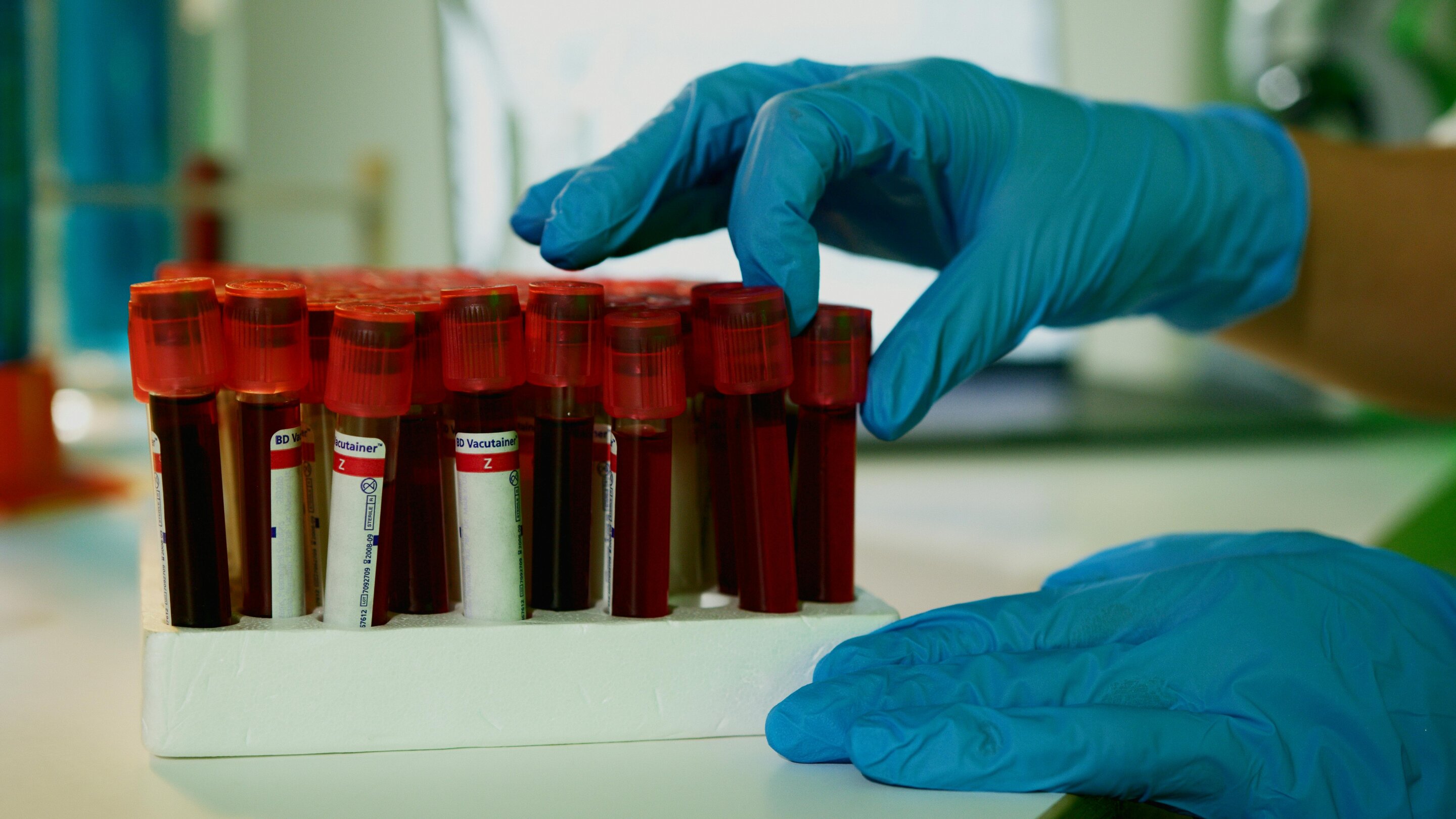 Simple Blood Tests Show Promise in Predicting Alzheimer’s Progression