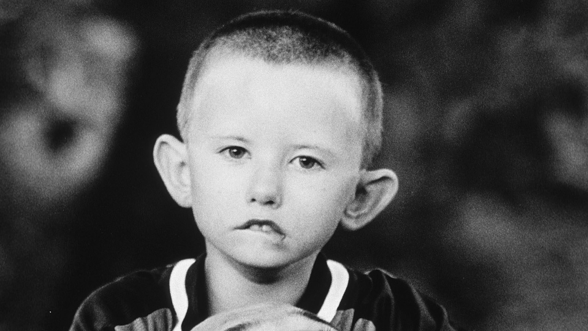 Featured image for Understanding Moebius Syndrome: The Rare Condition Affecting Smiles