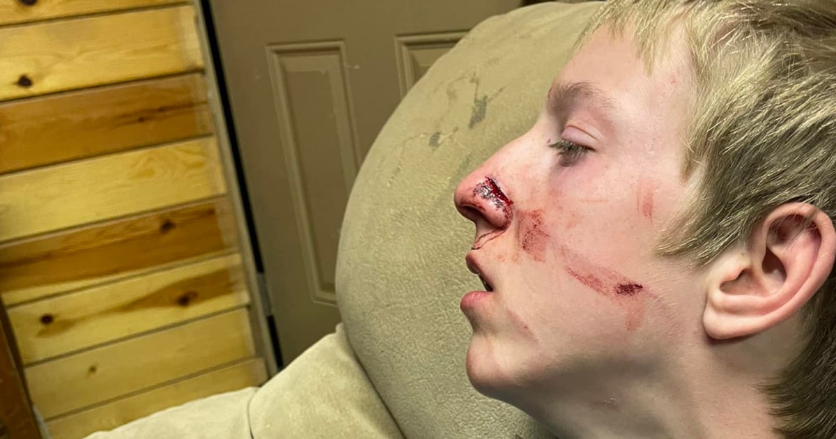 Arizona Teen Survives Rare Bear Attack in Cabin