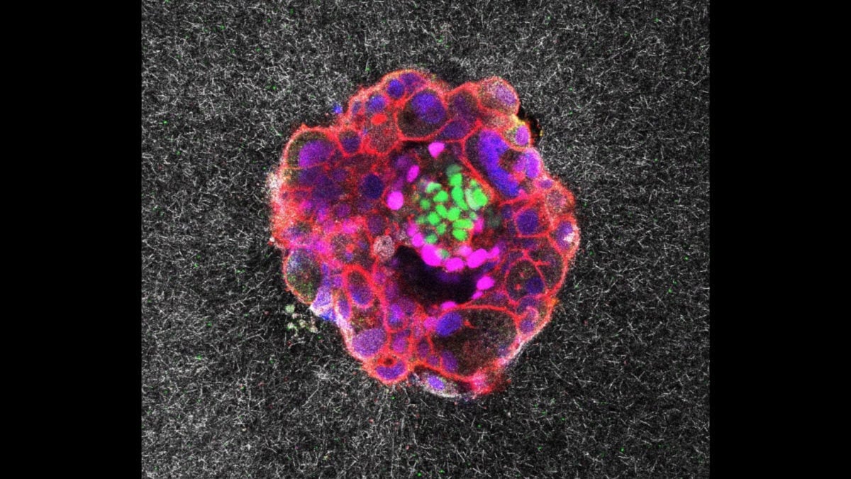 Featured image for Scientists Capture First Real-Time Footage of Human Embryo Implantation