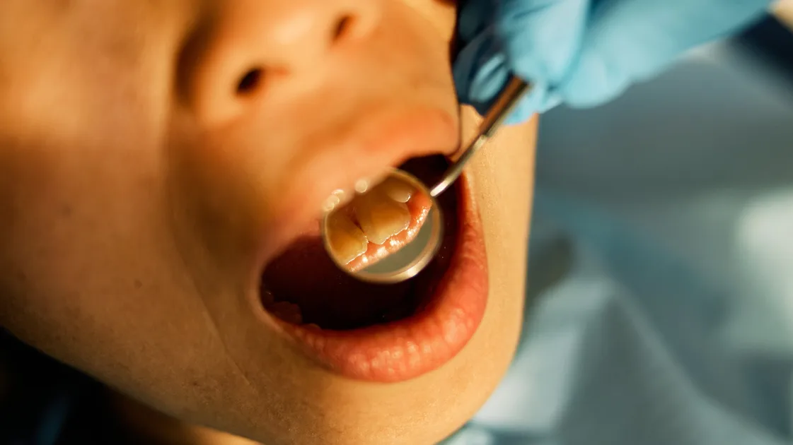 Featured image for Dentists Warn: Hidden Signs of Gum Disease You Must Watch For