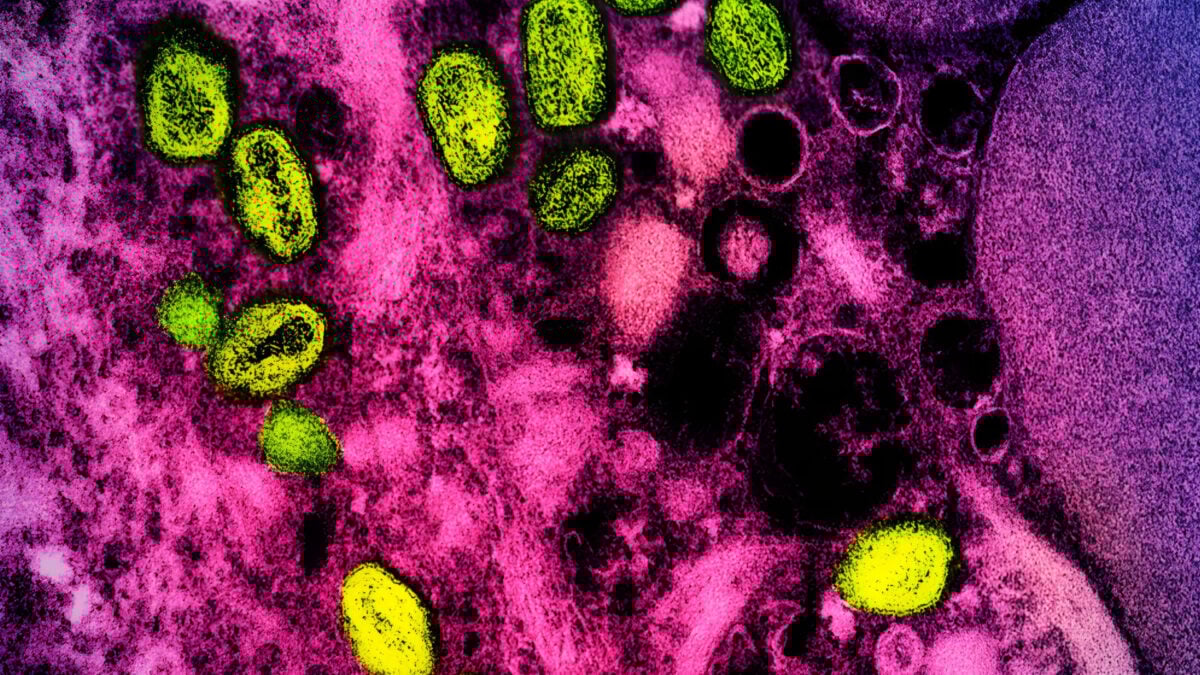 Featured image for Feds Reintroduce 'Monkeypox' Name After Dropping It in 2022