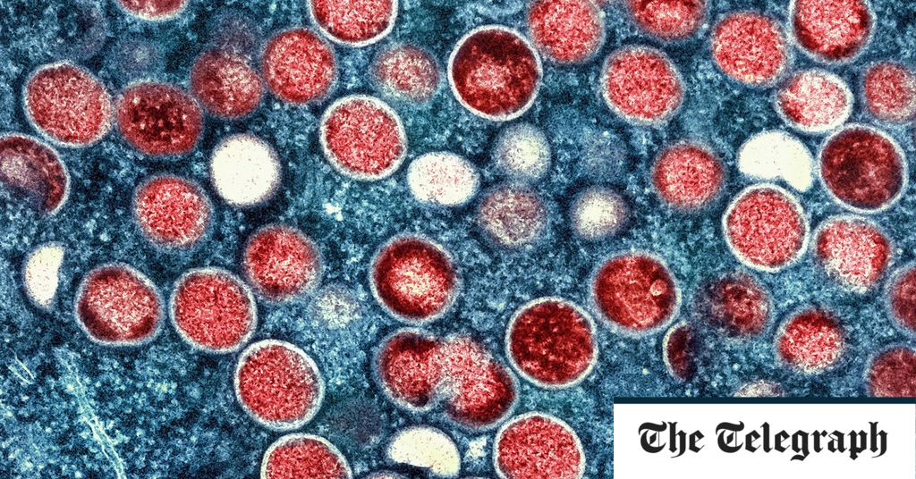 "Record-Breaking Mpox Outbreak in Congo: UN Confirms First Sexual Transmission"