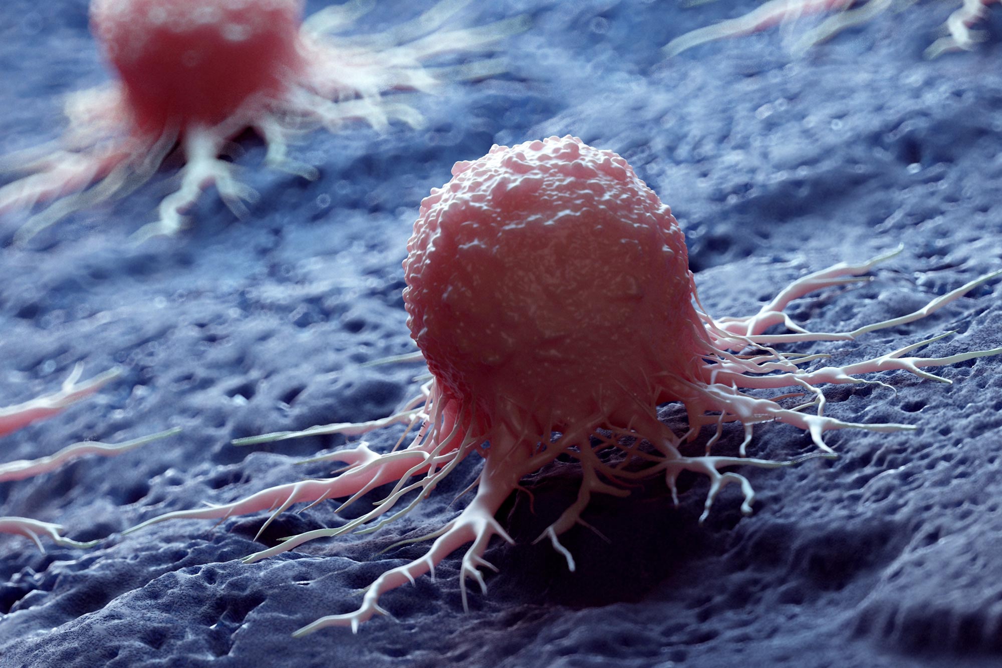 Featured image for Scientists Warn of Rising Global Cancer Deaths