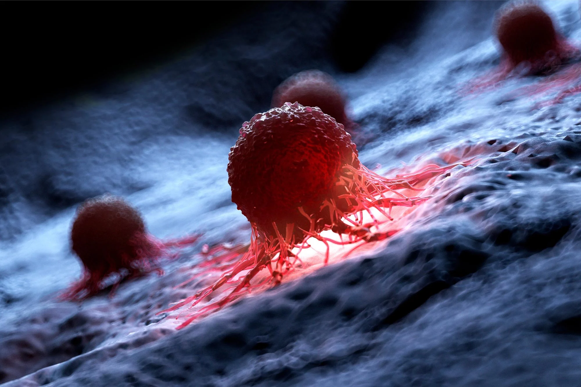 Featured image for New Supplement Found to Trigger Self-Destruction in Prostate Cancer Cells