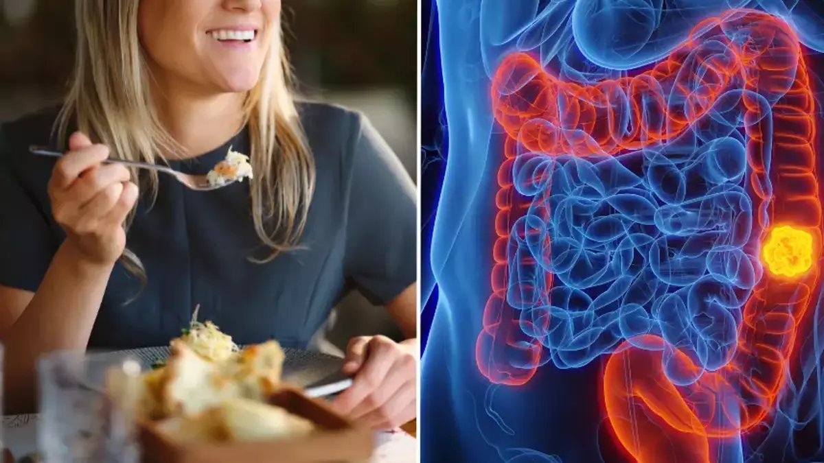 Featured image for Rising Colon Cancer in Young Adults Linked to Common Dietary Habits
