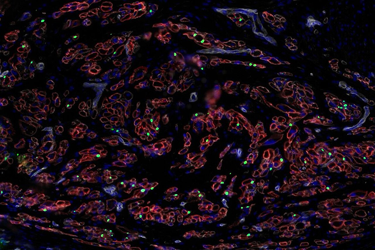 Featured image for Revolutionary Stem Cell Research Promises Muscle Regeneration