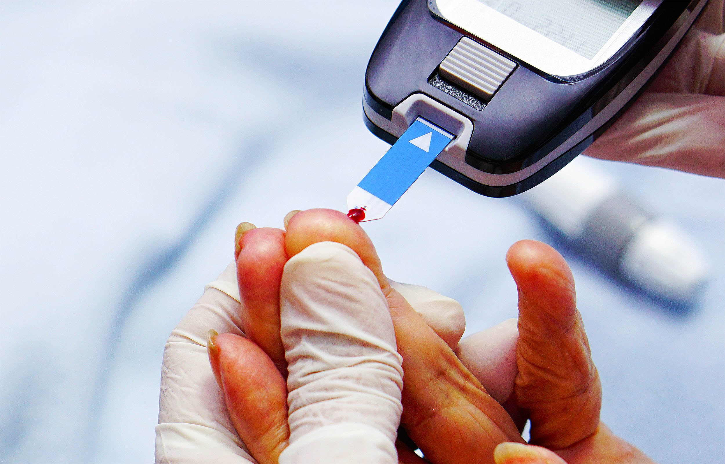 Featured image for Newly Recognized Diabetes Linked to Nutritional Deficiencies