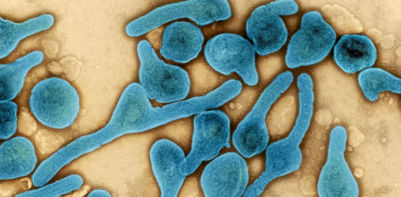 The Growing Threat of Marburg Virus Outbreaks: Expert Insights.