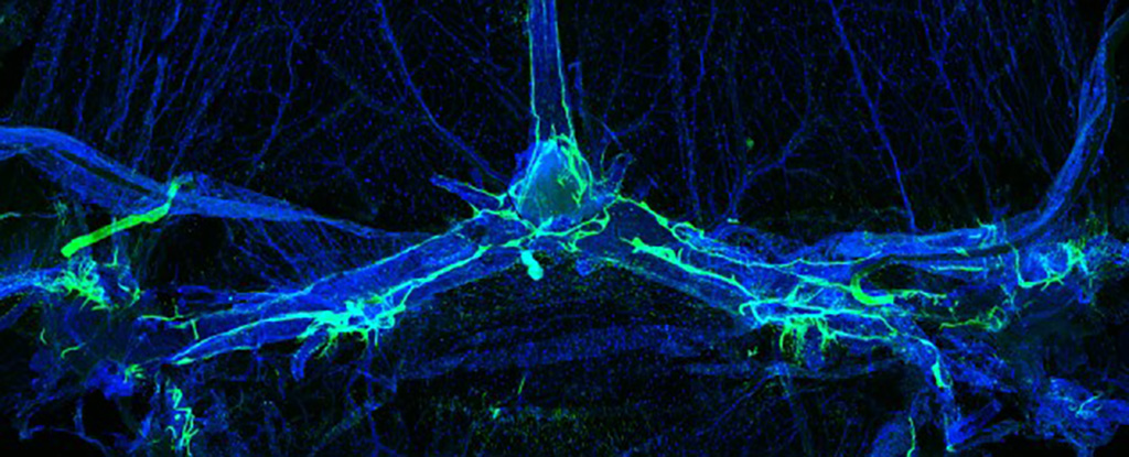 Featured image for Brain's Lymphatic Blockages Linked to Migraines, Study Finds