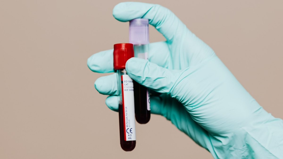 Featured image for Breakthrough Blood Test Offers New Hope for Detecting Chronic Fatigue Syndrome