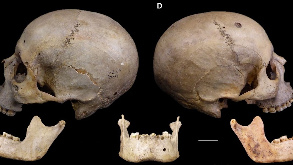 Featured image for Ancient Egyptian Skulls Reveal Early Cancer Treatments
