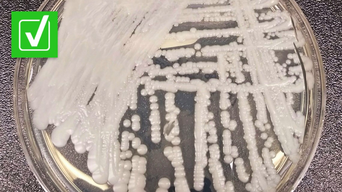 Featured image for The Spread of Drug-Resistant Fungus in U.S. Health Care Facilities.