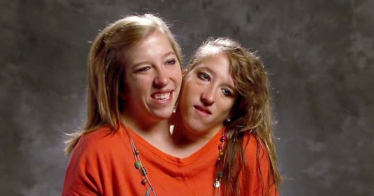 "Conjoined Twin Abby Hensel Ties the Knot"