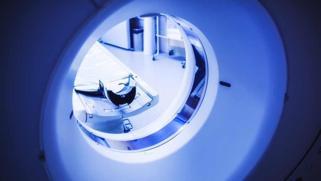 Low Screening Rates Contribute to High Mortality of Lung Cancer in the US