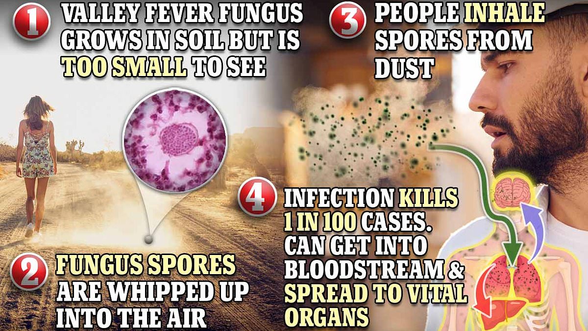 Featured image for "Climate Change to Trigger 25-Fold Surge in Valley Fever Fungus Cases, Warns CDC"