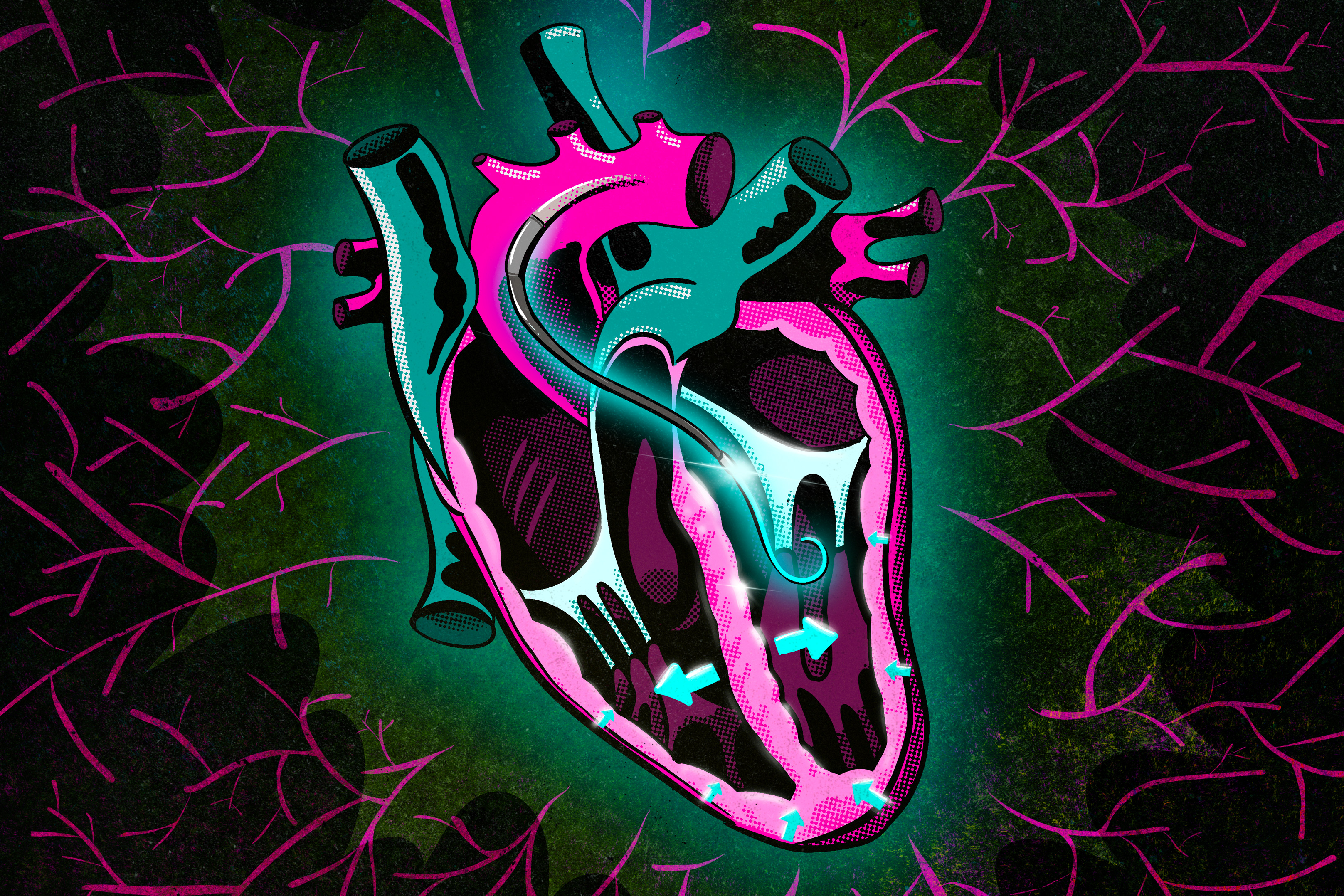 Featured image for "Predicting Heart Attack Patient Response to Mechanical Pumps: A Breakthrough Study"