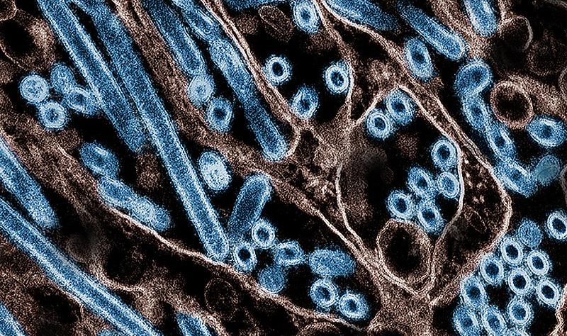 CDC Deploys Team to Colorado Amid Rising Human Bird Flu Cases