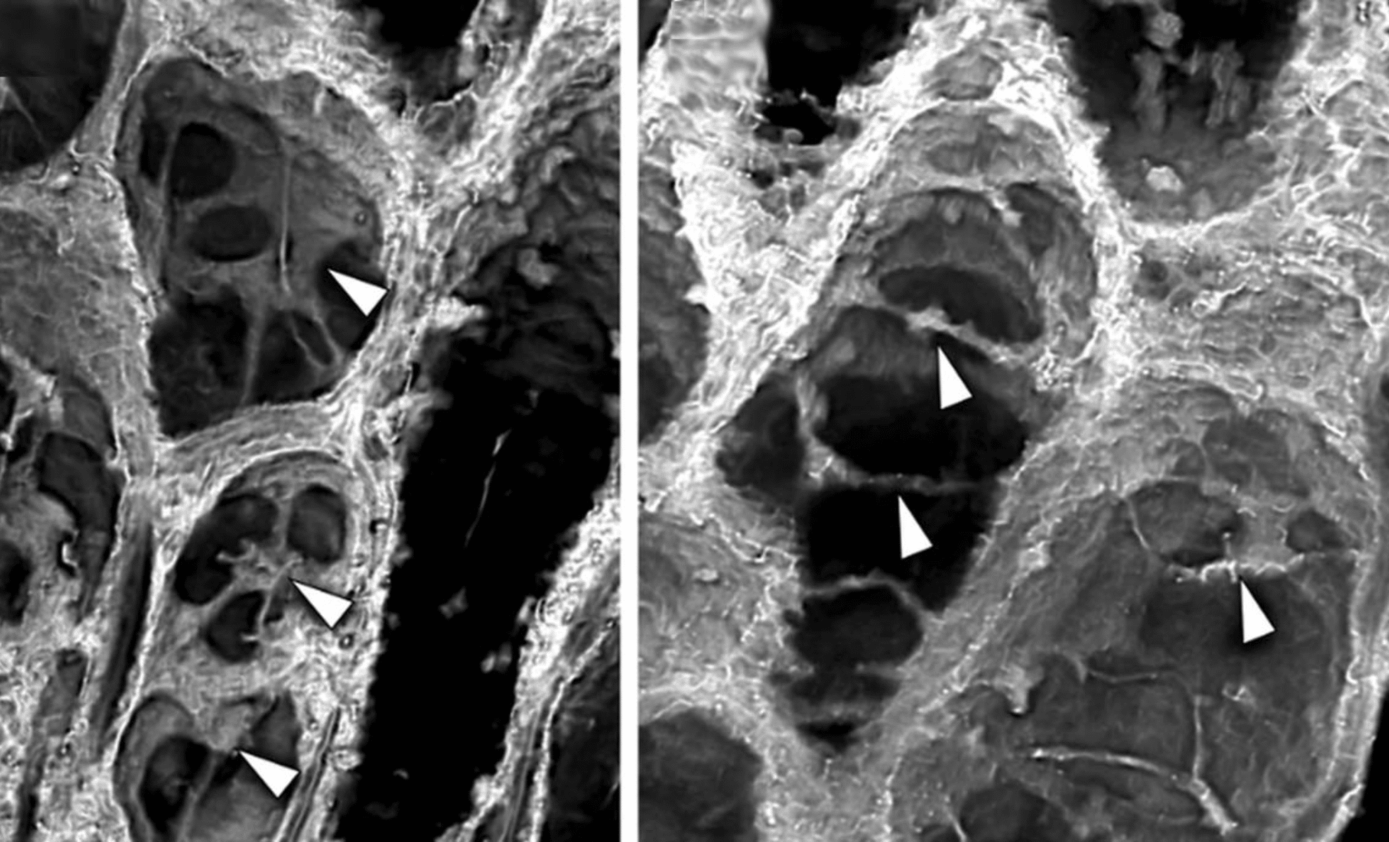 Featured image for Ancient Fossil Sheds Light on Early Plant Evolution