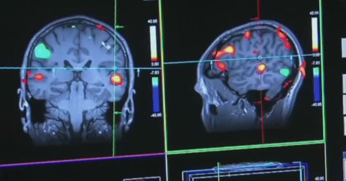Revolutionary Alzheimer's Detection and Treatment by BYU Scientists.