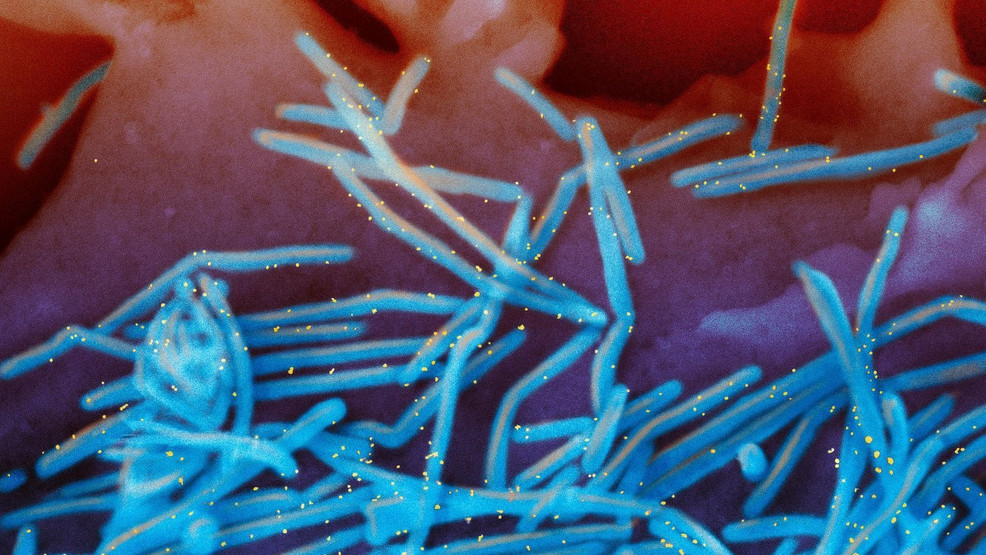 Featured image for Surge in Respiratory Illnesses Threatens Central Virginia