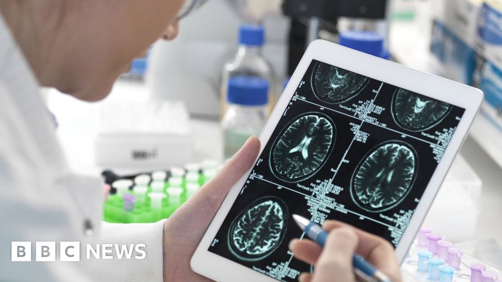 Alzheimer's Treatment Breakthrough Expected by 2040