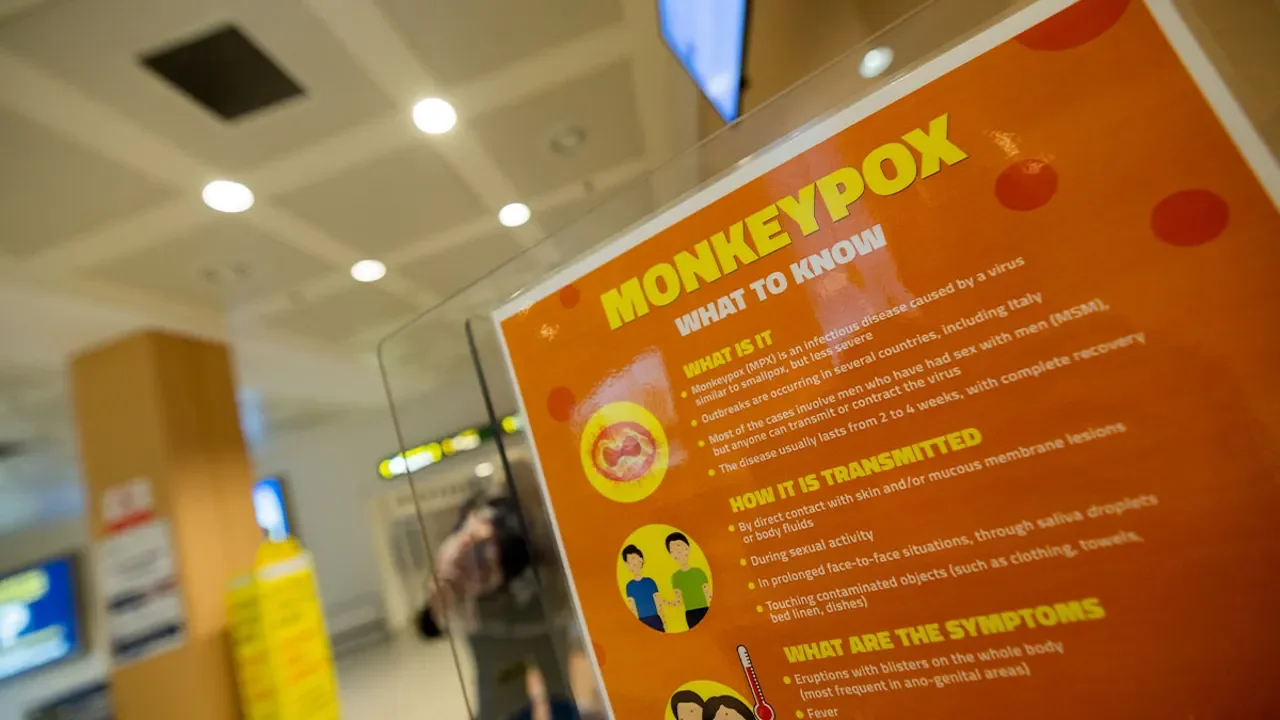 Monkeypox Cases Reported in Minnesota and Milwaukee