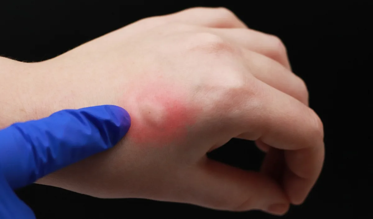 Featured image for Authorities Warn of Disease Spread Across US Region