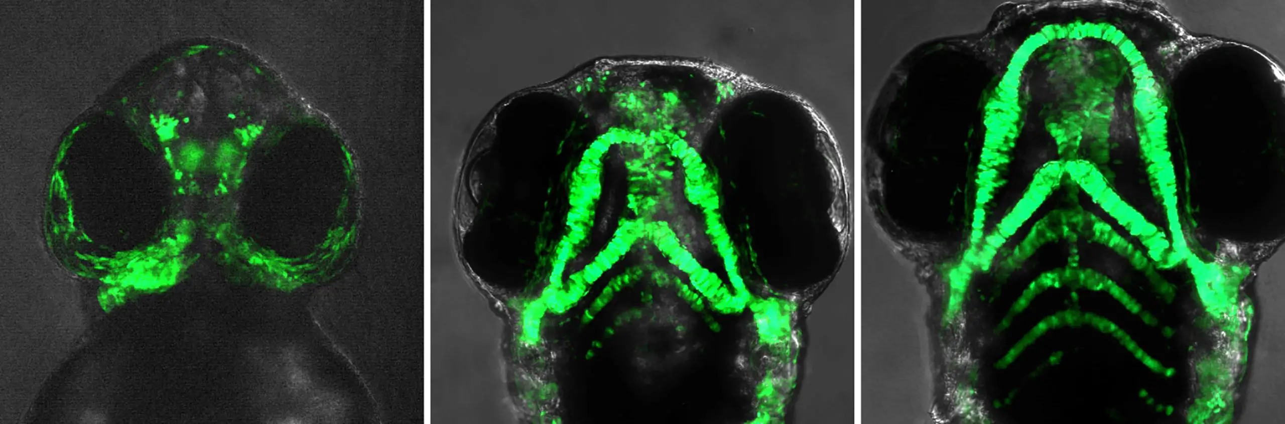 Featured image for The Surprising Impact of Common Drugs on Human Facial Development