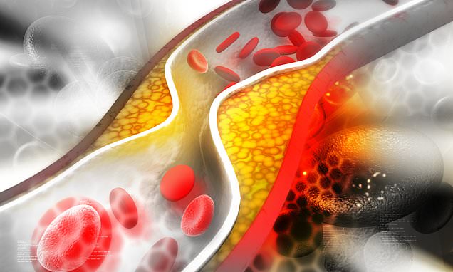Featured image for The Surprising Link Between High 'Good' Cholesterol and Dementia