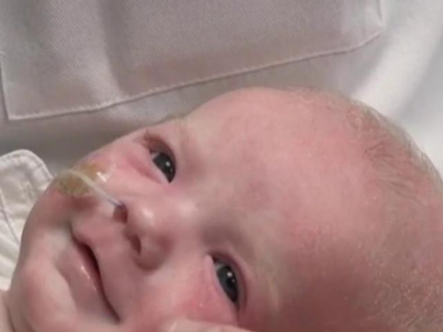 Featured image for "Infant Thrives After World's First Growing Heart Transplant Procedure"