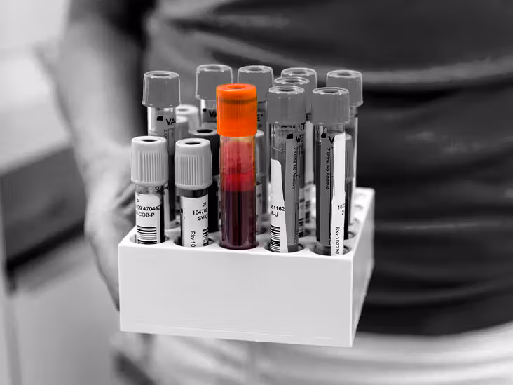 Featured image for "Breakthrough Blood Test for Early Alzheimer's Detection"