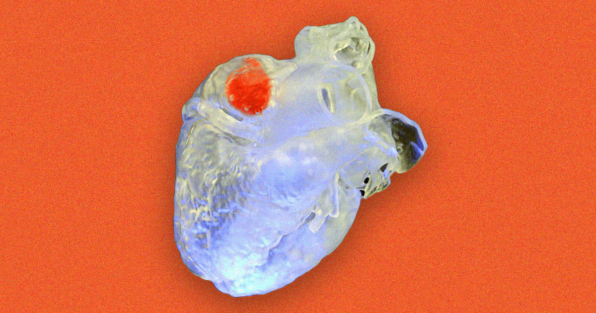 Featured image for Revolutionary Ultrasound-Assisted 3D Printing Technology Transforms Surgery