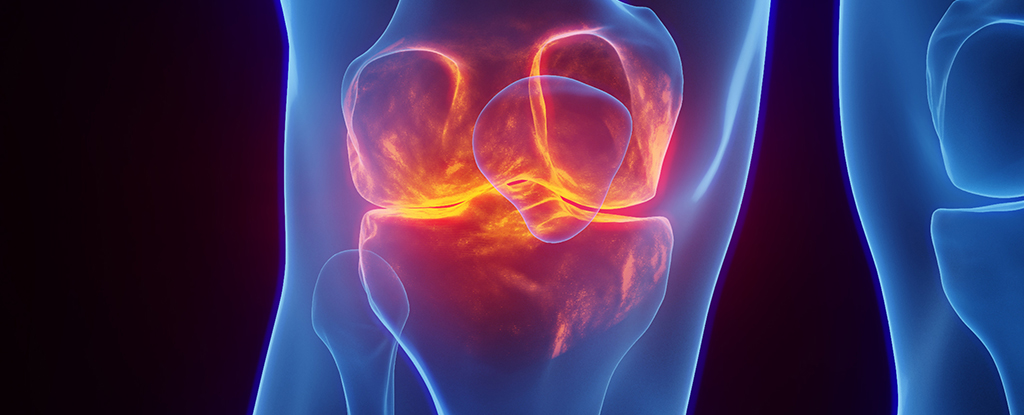 Featured image for Obesity Drug Ozempic Offers Hope for Knee Osteoarthritis Relief