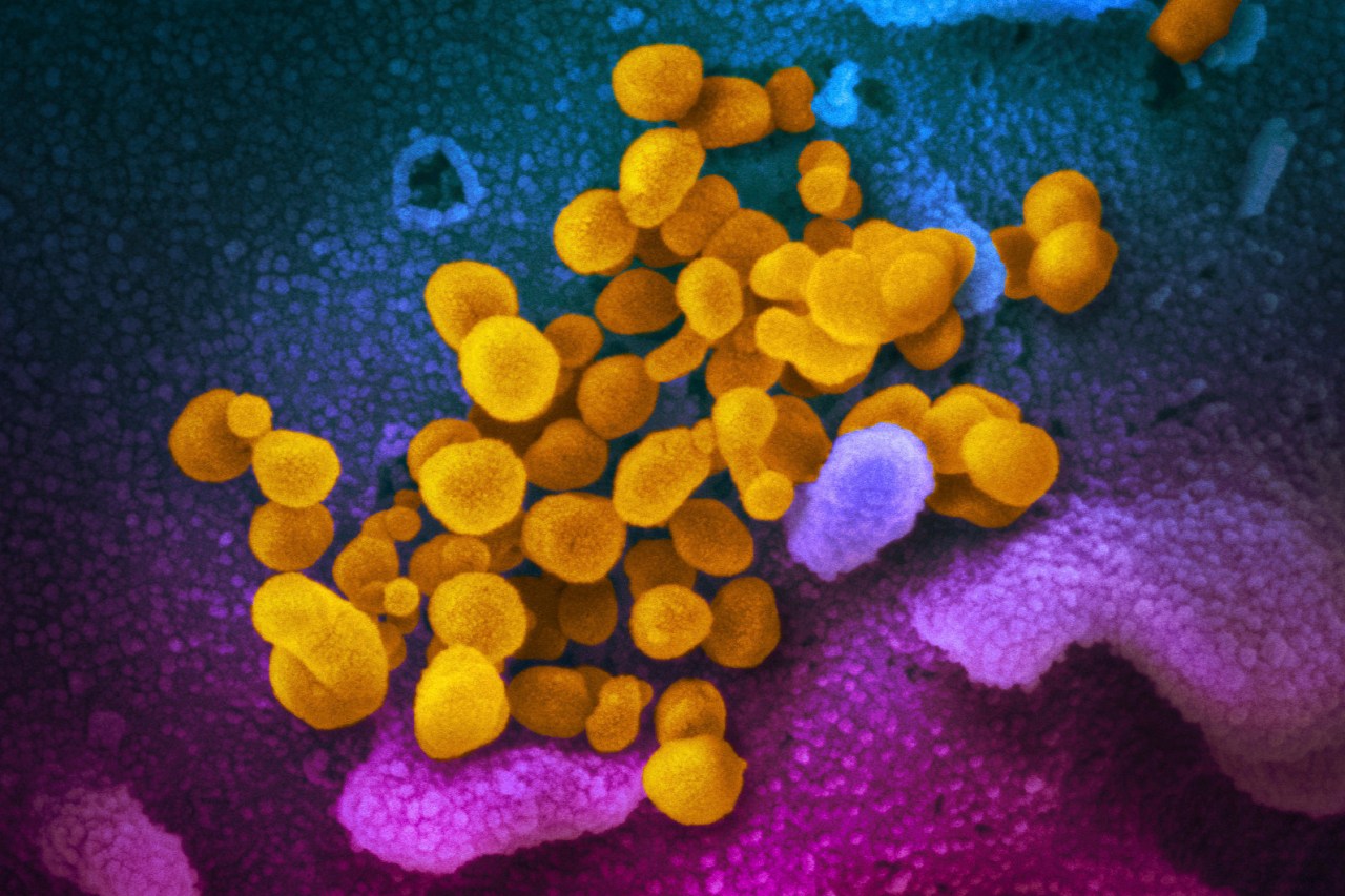 "New Study Identifies Key Symptoms of Long COVID After Omicron"