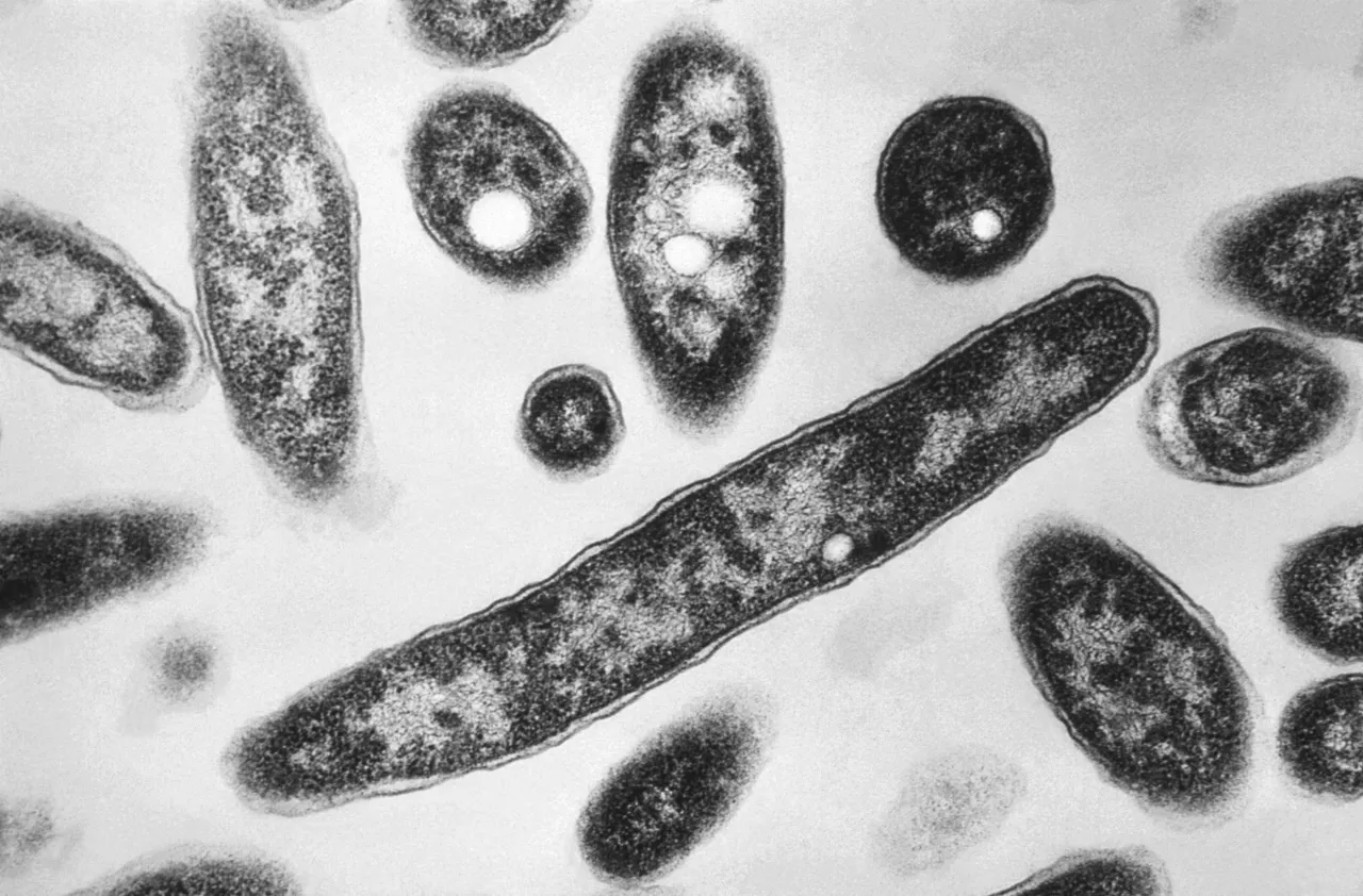 Featured image for Legionnaires’ Disease Outbreak in Marshalltown, Iowa: 21 Cases and 1 Death