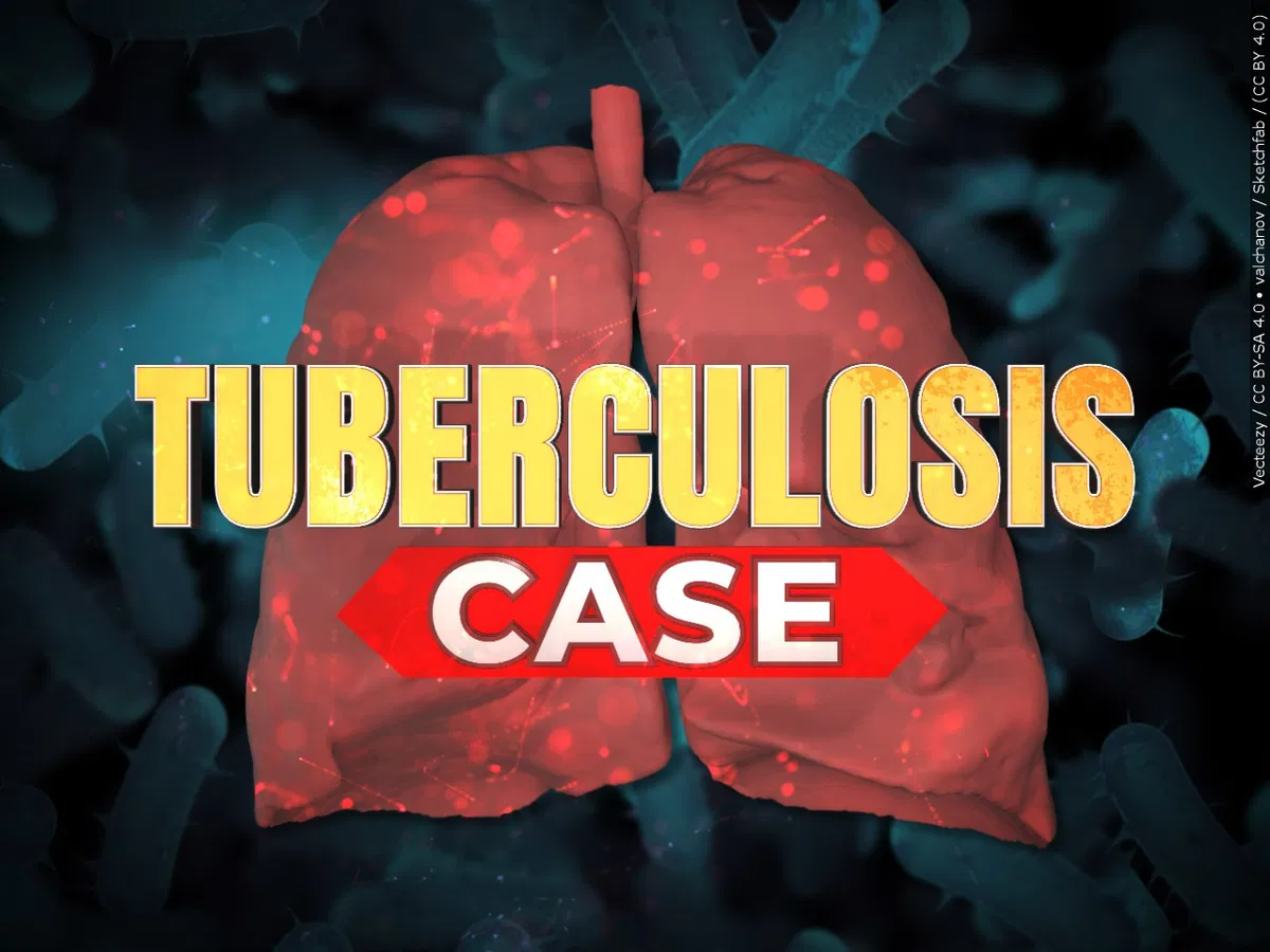Featured image for Tuberculosis Case Detected in Indio