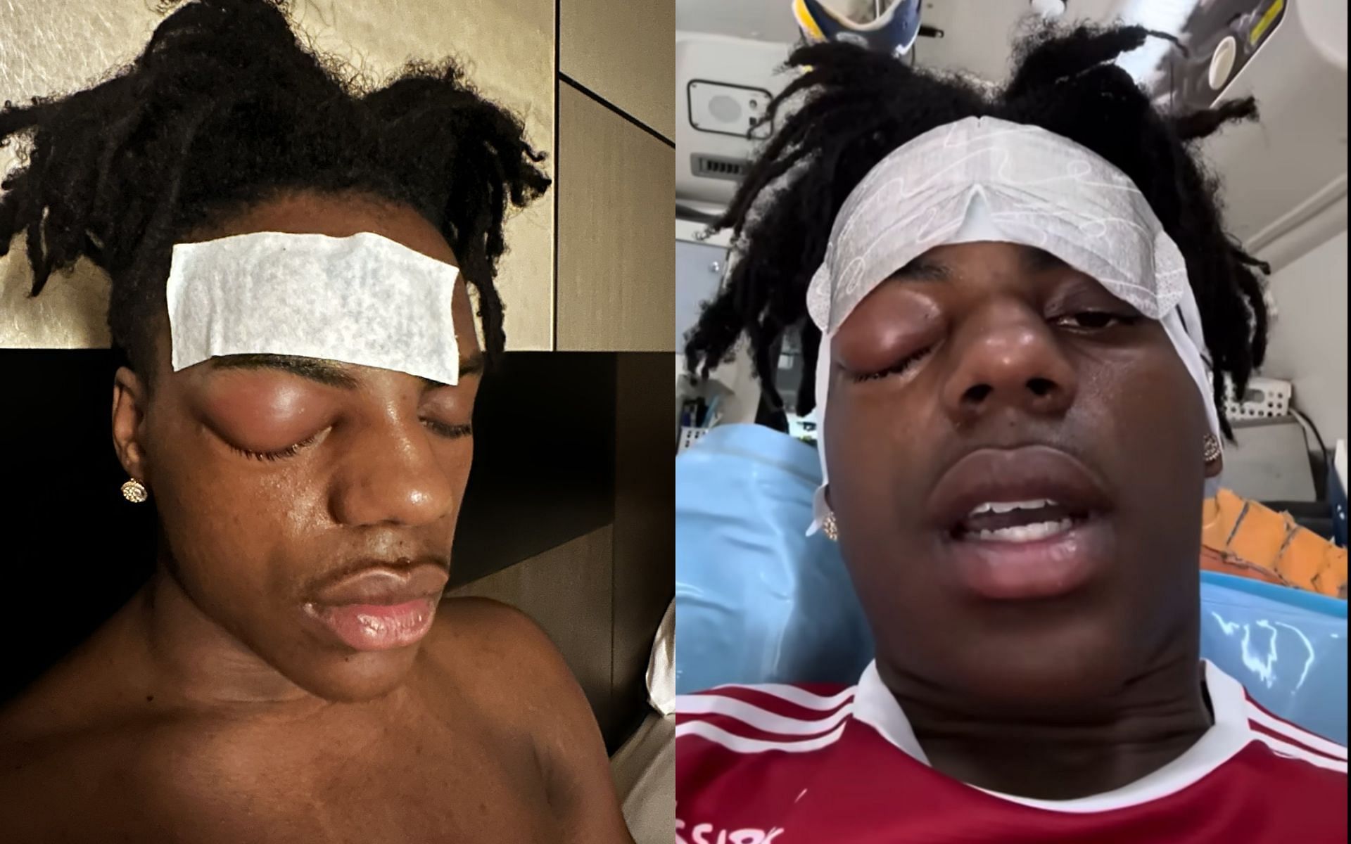 Featured image for IShowSpeed's Health Crisis: From Agonizing Headache to Surgery