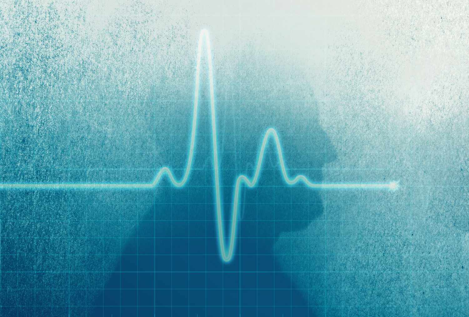 Featured image for Link Between Early Onset Heart Disease and Increased Dementia Risk Revealed