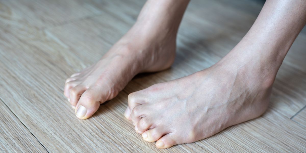 Featured image for "Unusual and Permanent Symptoms of Vitamin B12 Deficiency: A Clinical Evaluation"