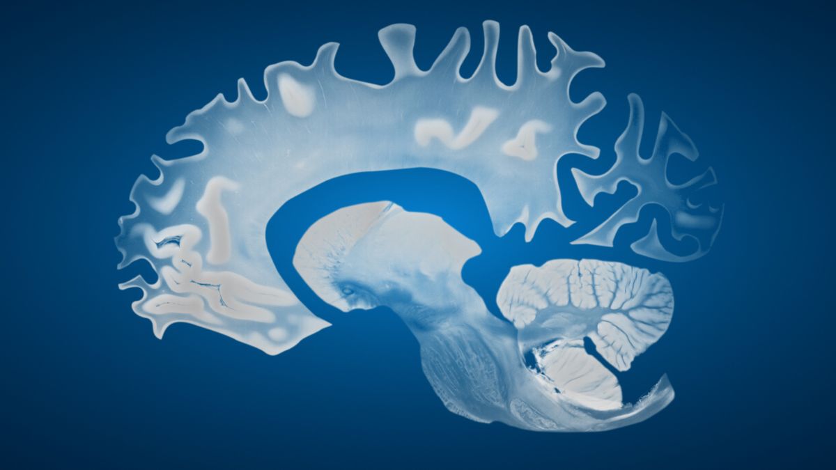 Featured image for Male Brains Age Faster Than Female Brains, But Why?