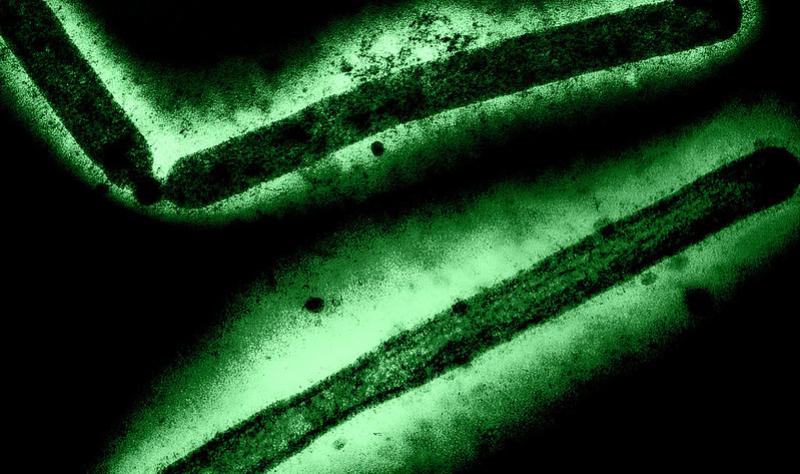 First US Child Diagnosed with H5N1 Bird Flu in California