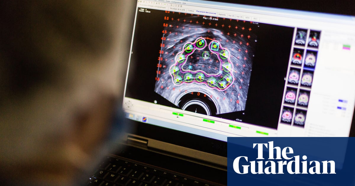 Featured image for Unraveling the Genetic Links to Prostate Cancer Risk in Black Men