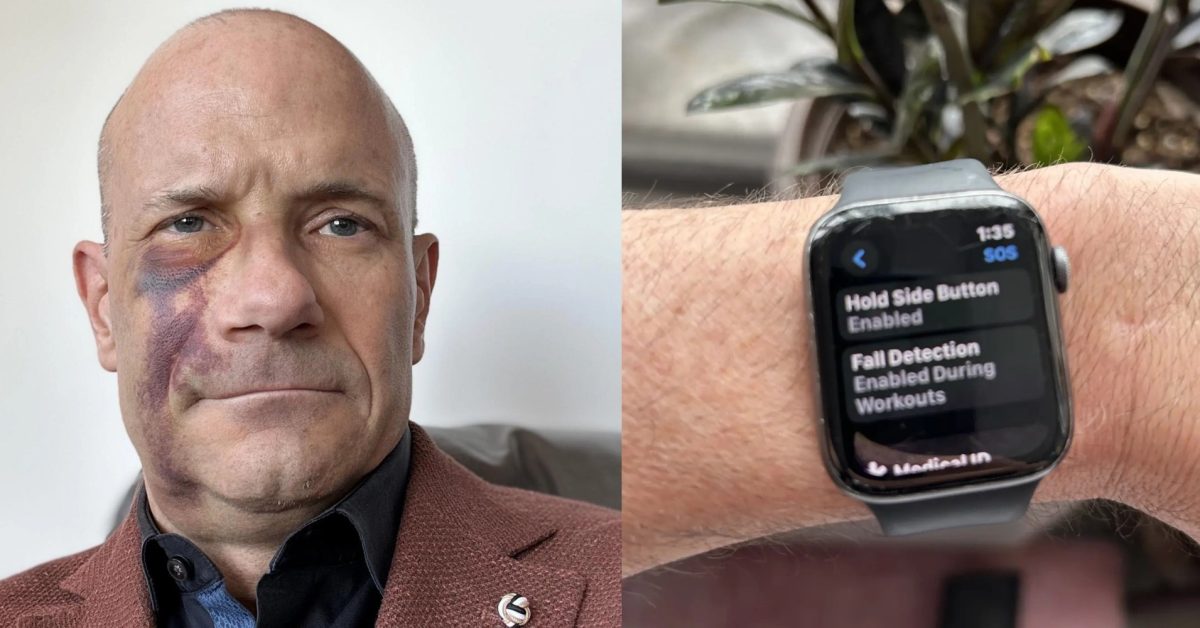 Featured image for "Apple Watch Fall Detection Saves Cyclist's Life in Emergency Crash"