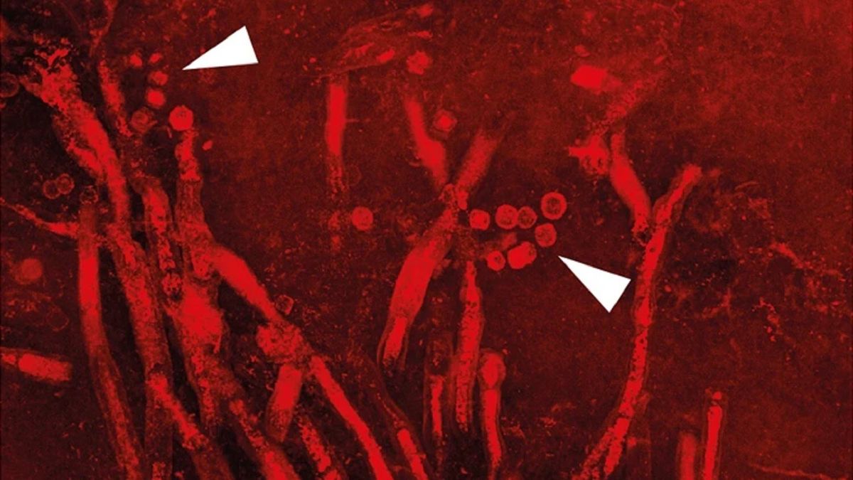 Ancient Fossil Unveils Oldest Disease-Causing Fungus