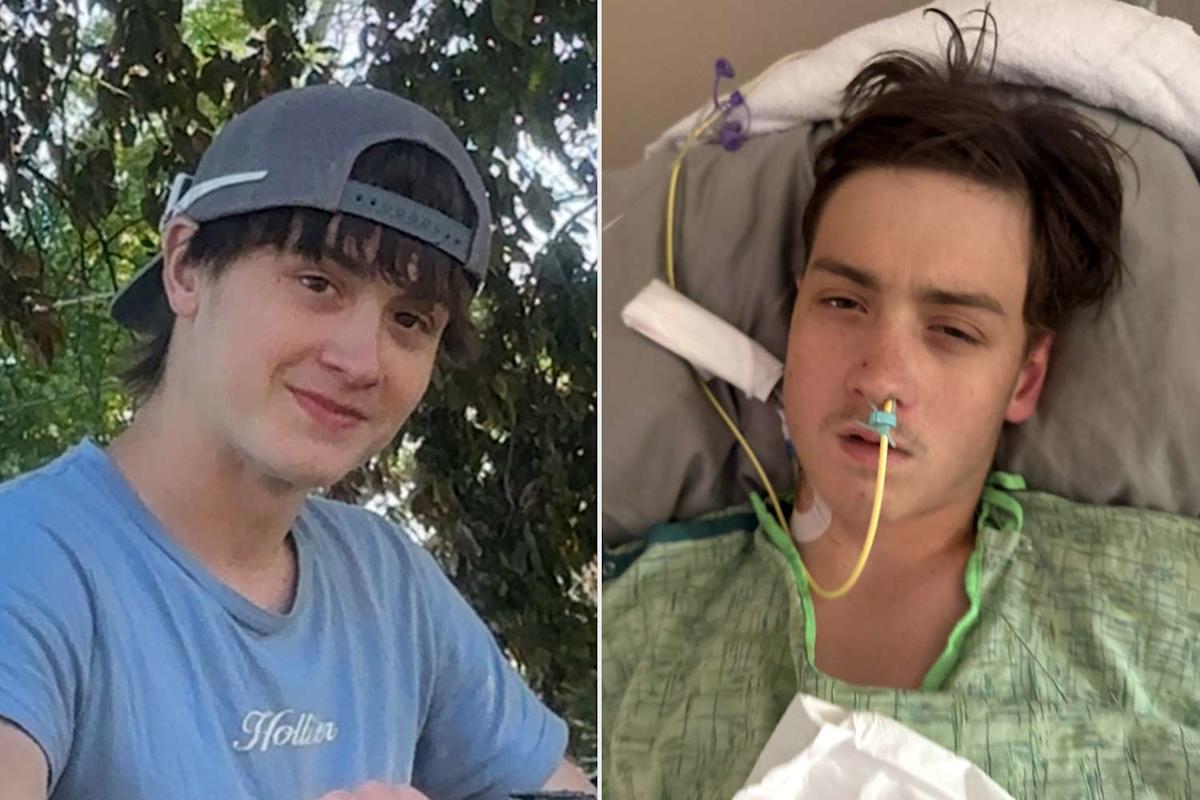 Featured image for Iowa Teen in Critical Condition After Spider Bite